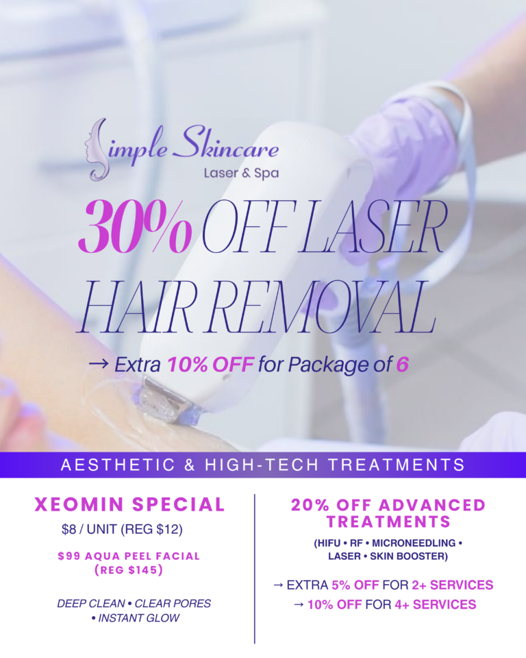 SIMPLE P1_APRIL PROMO(8)